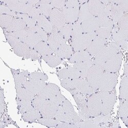 non-muscle heavy chain 10 Myosin Antibody, Novus Biologicals:Antibodies:Primary