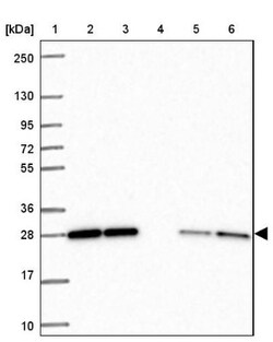 p107 Antibody, Novus Biologicals 0.1mL; Unlabeled:Antibodies, Polyclonal