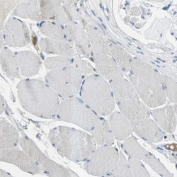 p120-catenin Antibody, Novus Biologicals 0.1mL; Unlabeled:Antibodies, Polyclonal