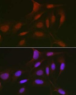 p130 Rabbit anti-Human, Mouse, Polyclonal, Novus Biologicals 20 &mu;g;