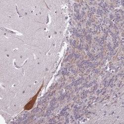 p130Cas/BCAR1 Antibody, Novus Biologicals:Antibodies:Primary Antibodies