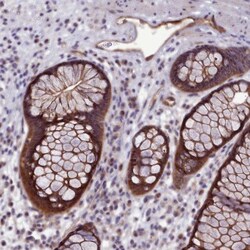 p130Cas/BCAR1 Antibody, Novus Biologicals:Antibodies:Primary Antibodies