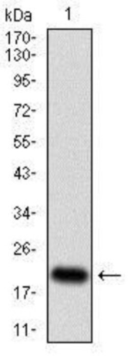 p16INK4a/CDKN2A Antibody (1D7D2A1) - BSA Free, Novus Biologicals 0.025