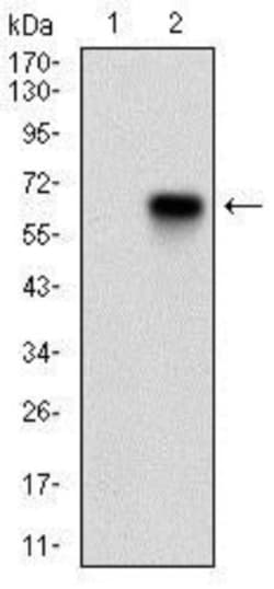p16INK4a/CDKN2A Antibody (1D7D2A1) - BSA Free, Novus Biologicals 0.025