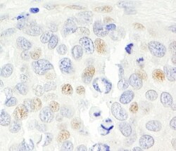 p14ARF/CDKN2A Antibody, Novus Biologicals 0.1mL; Unlabeled:Antibodies,