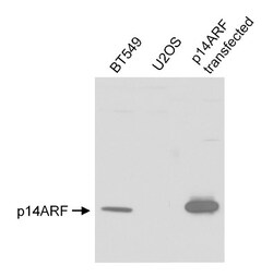 p14ARF/CDKN2A Antibody, Novus Biologicals 0.1mL; Unlabeled:Antibodies,