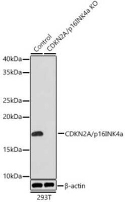 p16INK4a/CDKN2A Rabbit anti-Human, Clone: 0D0C8, Novus Biologicals 20 &mu;g | Buy Online | Novus Biologicals | Fisher Scientific
