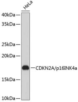 p16INK4a/CDKN2A Rabbit anti-Human, Clone: 0D0C8, Novus Biologicals 20 &mu;g | Buy Online | Novus Biologicals | Fisher Scientific