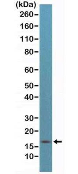 p16INK4a/CDKN2A Antibody (RM267), Novus Biologicals 100 &mu;g | Buy Online | Novus Biologicals | Fisher Scientific