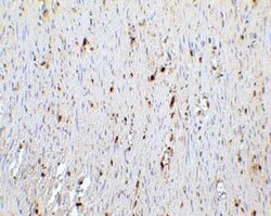 p16INK4a/CDKN2A Antibody - BSA Free, Novus Biologicals 0.1 mg; Unconjugated:Antikörper