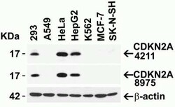 p16INK4a/CDKN2A Antibody - BSA Free, Novus Biologicals 0.1 mg; Unconjugated:Antikörper