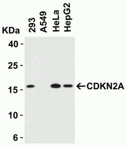 p16INK4a/CDKN2A Antibody - BSA Free, Novus Biologicals 0.1 mg; Unconjugated:Antikörper