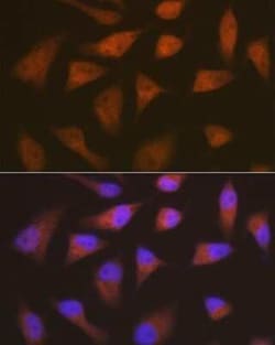 p18INK4c/CDKN2C Rabbit anti-Human, Mouse, Rat, Clone: 1Q10Q4, Novus Biologicals 100 &mu;g | Buy Online | Novus Biologicals | Fisher Scientific