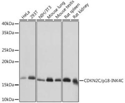 p18INK4c/CDKN2C Rabbit anti-Human, Mouse, Rat, Clone: 1Q10Q4, Novus Biologicals 100 &mu;g | Buy Online | Novus Biologicals | Fisher Scientific