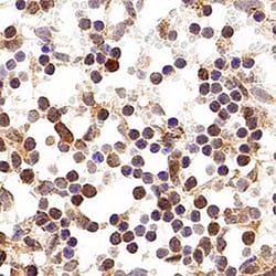 p19ARF/CDKN2A Antibody - BSA Free, Novus Biologicals:Antibodies:Primary