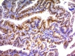 p21/CIP1/CDKN1A Antibody (DCS-60.2), Novus Biologicals 0.2mg; Unlabeled:Antibodies,