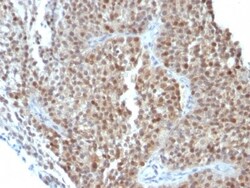p21/CIP1/CDKN1A Antibody (CIP1/823 + DCS-60.2), Novus Biologicals 0.2mg;