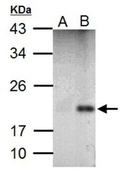 p21/CIP1/CDKN1A Antibody, Novus Biologicals 0.1 mL | Buy Online | Novus Biologicals | Fisher Scientific