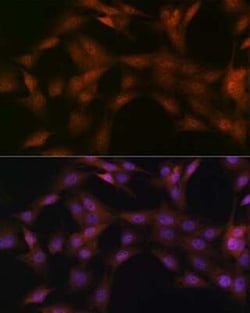 p23/PTGES3 Rabbit anti-Human, Mouse, Rat, Clone: 10M9W8, Novus Biologicals