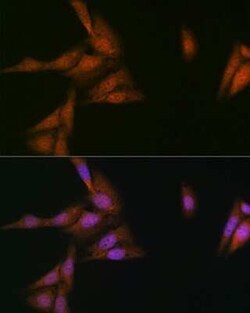 p23/PTGES3 Rabbit anti-Human, Mouse, Rat, Clone: 10M9W8, Novus Biologicals