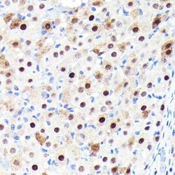 p27/Kip1 Rabbit anti-Human, Mouse, Rat, Clone: 9R5B4, Novus Biologicals