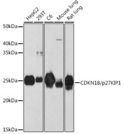 p27/Kip1 Rabbit anti-Human, Mouse, Rat, Clone: 9R5B4, Novus Biologicals