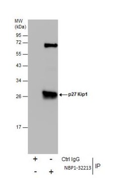 p27/Kip1 Antibody, Novus Biologicals 0.1mL; Unlabeled:Antibodies, Polyclonal