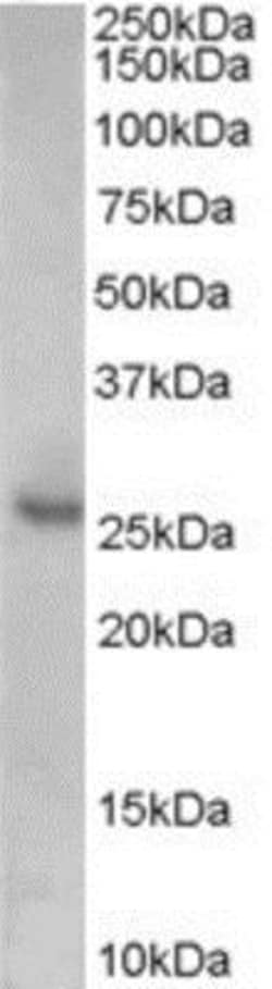 p27/Kip1 Antibody, Novus Biologicals 0.1mg; Unlabeled:Antibodies, Polyclonal