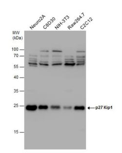p27/Kip1 Antibody, Novus Biologicals 0.1mL; Unlabeled:Antibodies, Polyclonal