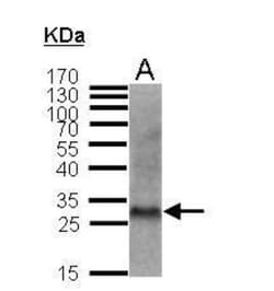 p27/Kip1 Antibody, Novus Biologicals 0.1mL; Unlabeled:Antibodies, Polyclonal