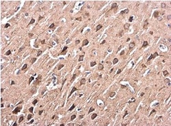 p38 alpha Antibody, Novus Biologicals 0.1mL; Unlabeled:Antibodies, Polyclonal