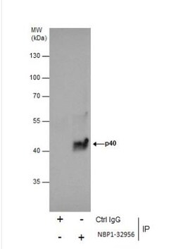 p40 Antibody, Novus Biologicals 0.1mg; Unlabeled:Antibodies, Polyclonal