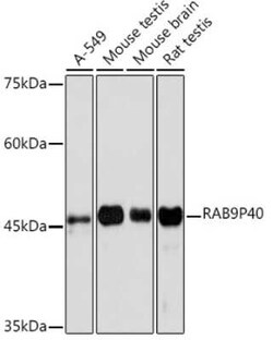 p40 Rabbit anti-Human, Mouse, Rat, Clone: 10E2A4, Novus Biologicals 100