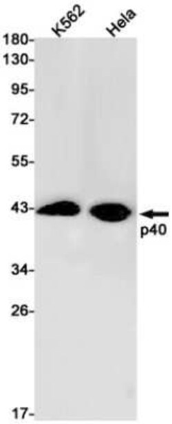 p40 Rabbit anti-Human, Clone: S06-8K2, Novus Biologicals 100 &mu;g; Unconjugated:Antibodies,