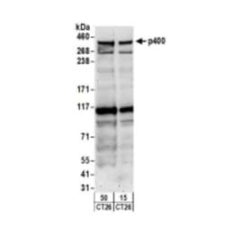 p400 Antibody, Novus Biologicals 0.1mL; Unlabeled:Antibodies, Polyclonal