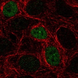 p53 Antibody (CL2199), Novus Biologicals 0.1mL; Unlabeled:Antibodies, Monoclonal