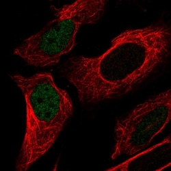 p53 Antibody (CL2199), Novus Biologicals 0.1mL; Unlabeled:Antibodies, Monoclonal