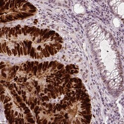 p53 Antibody (CL2199), Novus Biologicals 0.1mL; Unlabeled:Antibodies, Monoclonal