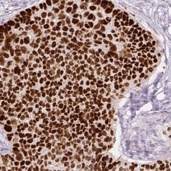 p53 Antibody (CL2199), Novus Biologicals 0.1mL; Unlabeled:Antibodies, Monoclonal