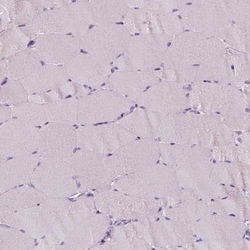 p53 Antibody (CL2199), Novus Biologicals 0.1mL; Unlabeled:Antibodies, Monoclonal