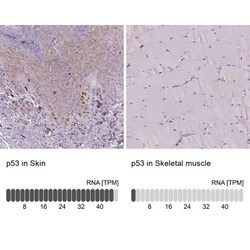 p53 Antibody (CL2199), Novus Biologicals 0.1mL; Unlabeled:Antibodies, Monoclonal