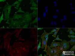 p53 Antibody (PAb 240) - BSA Free, Novus Biologicals:Antibodies:Primary