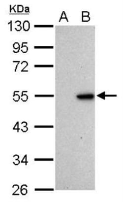 p53 Antibody (Pab1801), Novus Biologicals 0.1mg; Unlabeled:Antibodies,