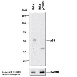 p53 Antibody (TRP/817), Novus Biologicals 0.2mg; Unlabeled:Antibodies,