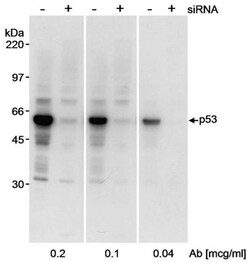 p53 Antibody, Novus Biologicals 0.1mL; Unlabeled:Antibodies, Polyclonal