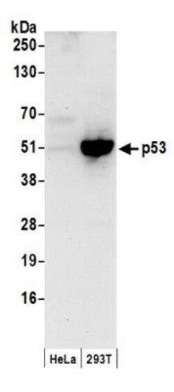 p53 Antibody, Novus Biologicals 0.1mL; Unlabeled:Antibodies, Polyclonal