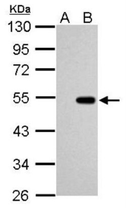 p53 Antibody, Novus Biologicals 0.1mL; Unlabeled:Antibodies, Polyclonal