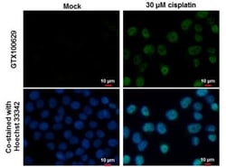 p53 Antibody, Novus Biologicals 0.1mL; Unlabeled:Antibodies, Polyclonal