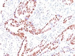 p57 Kip2 Antibody (KIP2/880), Novus Biologicals 0.2mg; Unlabeled:Antibodies,