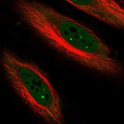 p57 Kip2 Antibody, Novus Biologicals 0.1mL; Unlabeled:Antibodies, Polyclonal